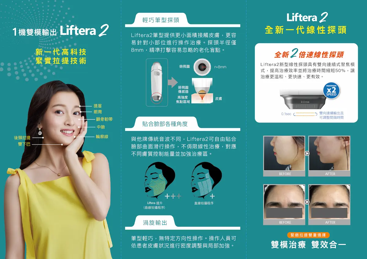 立特拉音波第二代 立特拉音波第二代 吳紹琥醫師